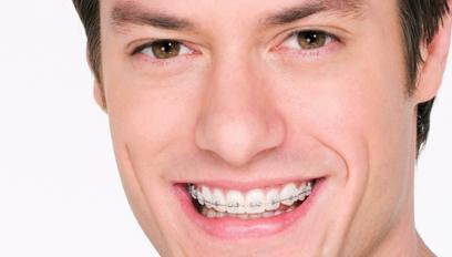 Adult Braces - Thomas Orthodontics