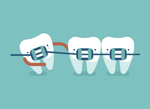 Avoid These Dental Disasters Caused By Braces | Thomas Orthodontics