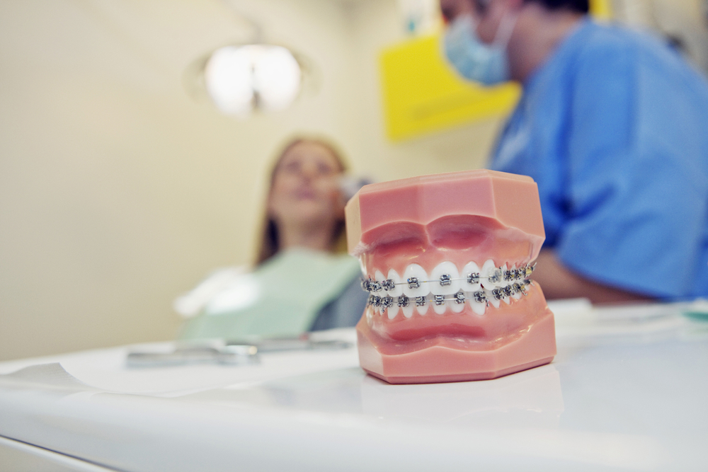 teeth model with braces patient and orthodontist in the background