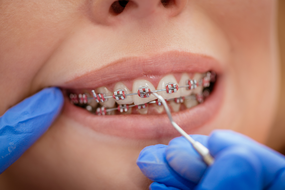 dentist checking patient's braces