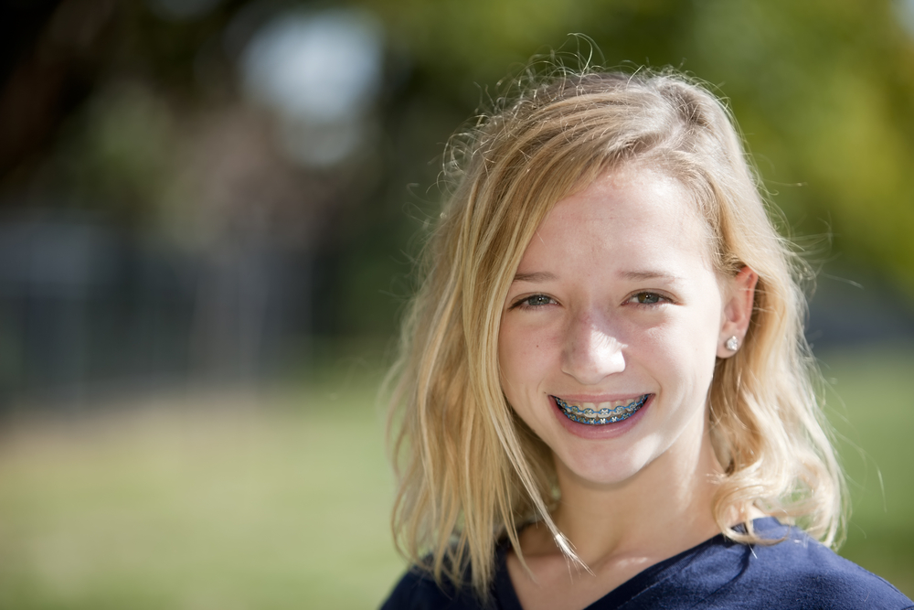 Dental implants for teenagers