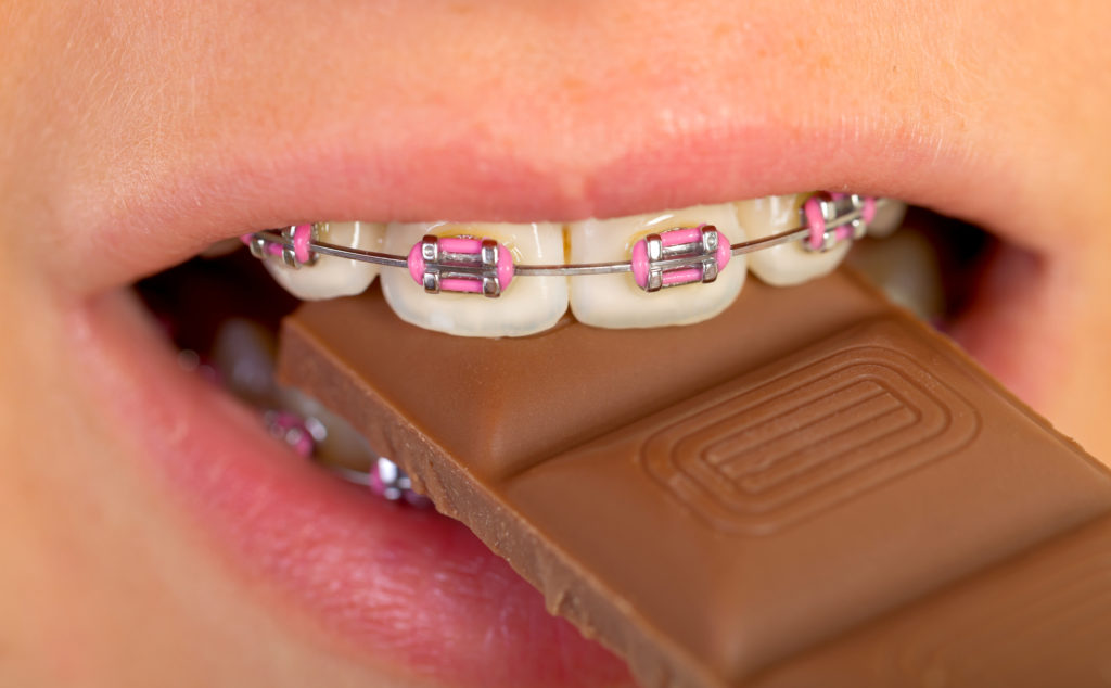 Girl with pink braces eating a chocolate Halloween candy.
