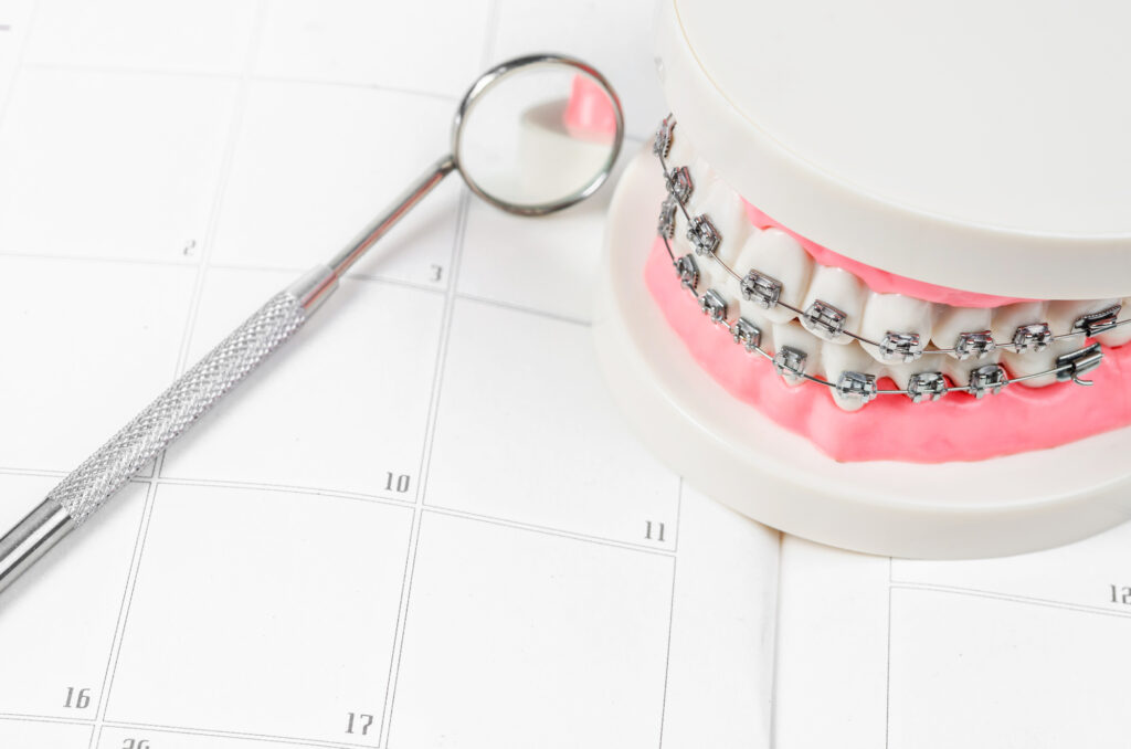 Tooth model with braces on calendar scheduling orthodontic appointment.