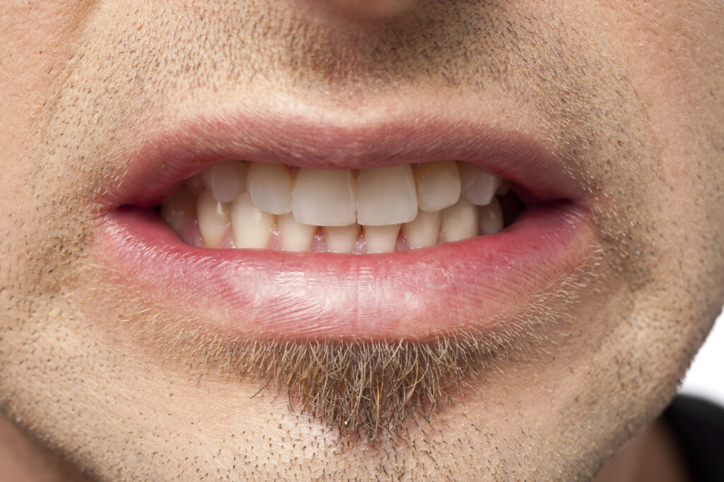 Close up of man grinding teeth. 