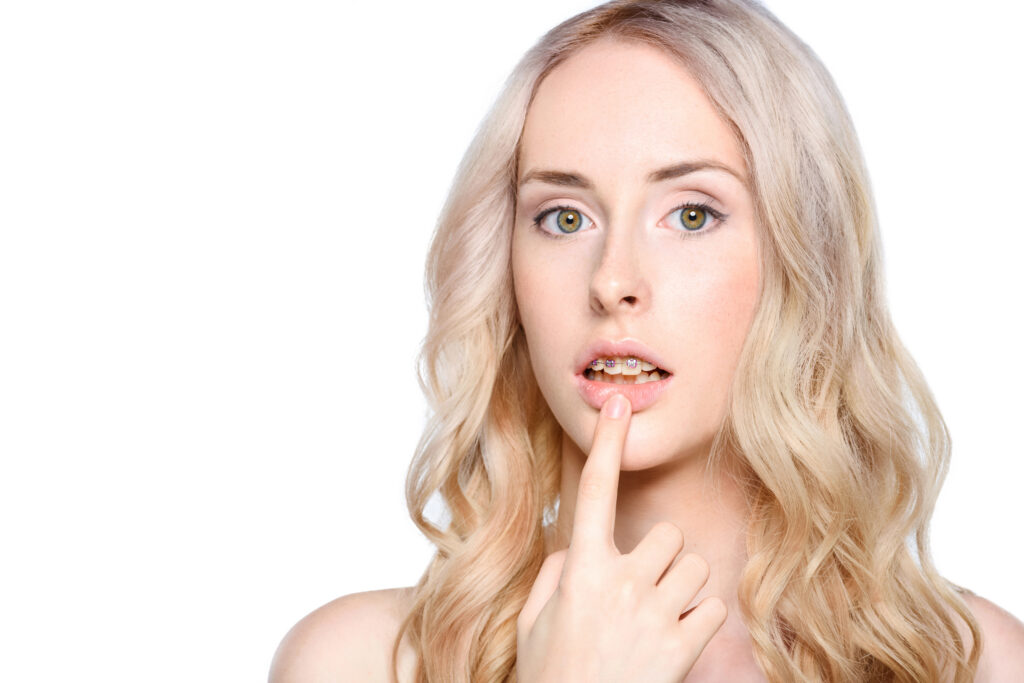 Woman with braces looking concerned